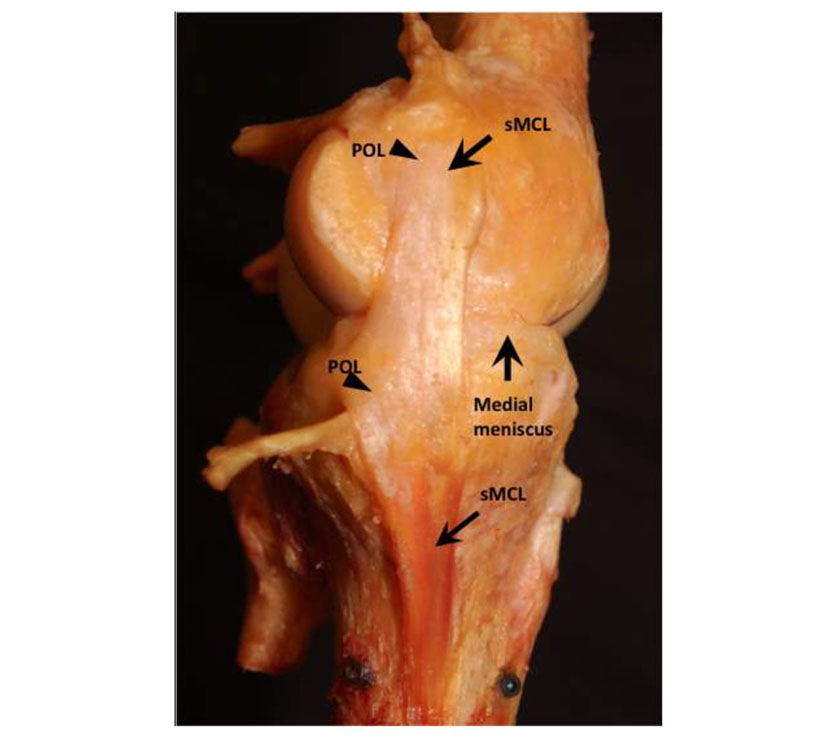 Cadaveric model of the anatomy of the sMCL